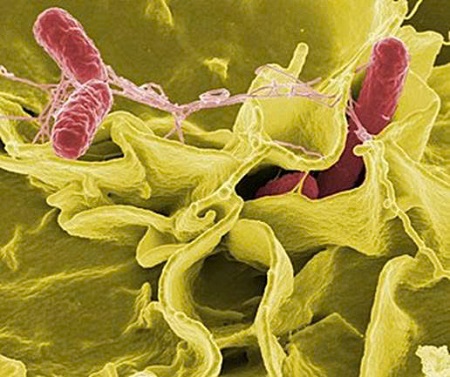 SALMONELLA, BOTULINUM VÀ VI KHUẨN TỤ CẦU VÀNG NHỮNG ĐIỀU CẦN BIẾT